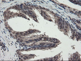 TDO2 Antibody - IHC of paraffin-embedded Human prostate tissue using anti-TDO2 mouse monoclonal antibody.