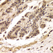 TDO2 Antibody - Immunohistochemistry of paraffin-embedded Human mammary gland tissue.