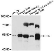 TDO2 Antibody - Western blot analysis of extracts of various cell lines, using TDO2 antibody at 1:500 dilution. The secondary antibody used was an HRP Goat Anti-Rabbit IgG (H+L) at 1:10000 dilution. Lysates were loaded 25ug per lane and 3% nonfat dry milk in TBST was used for blocking. An ECL Kit was used for detection and the exposure time was 5s.