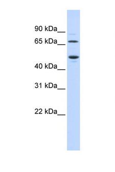 TDO2 Antibody - TDO2 antibody Western blot of Fetal Heart lysate. Antibody concentration 1 ug/ml. This image was taken for the unconjugated form of this product. Other forms have not been tested.