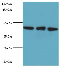 TDP-43 / TARDBP Antibody - Western blot. All lanes: TAR DNA-binding protein 43 antibody at 8 ug/ml. Lane 1: HeLa whole cell lysate. Lane 2: mouse spleen tissue. Lane: K562 whole cell lysate. secondary Goat polyclonal to rabbit at 1:10000 dilution. Predicted band size: 45 kDa. Observed band size: 45 kDa.