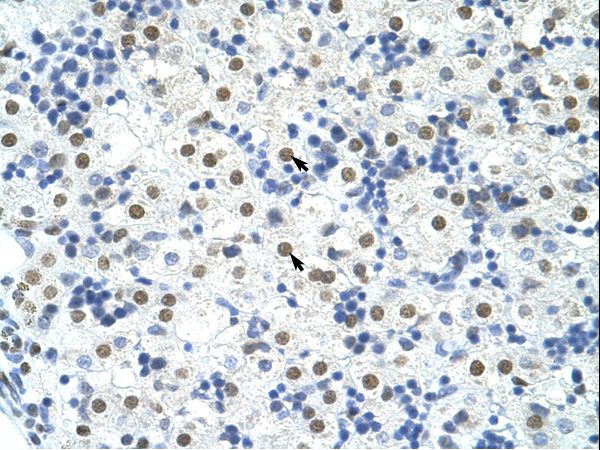TDP-43 / TARDBP Antibody - TARDBP antibody ARP38942_T100-NP_031401-TARDBP (TAR DNA binding protein) Antibody was used in IHC to stain formalin-fixed, paraffin-embedded human liver.  This image was taken for the unconjugated form of this product. Other forms have not been tested.