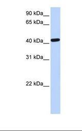 TDP-43 / TARDBP Antibody - Fetal liver lysate. Antibody concentration: 1.0 ug/ml. Gel concentration: 12%.  This image was taken for the unconjugated form of this product. Other forms have not been tested.