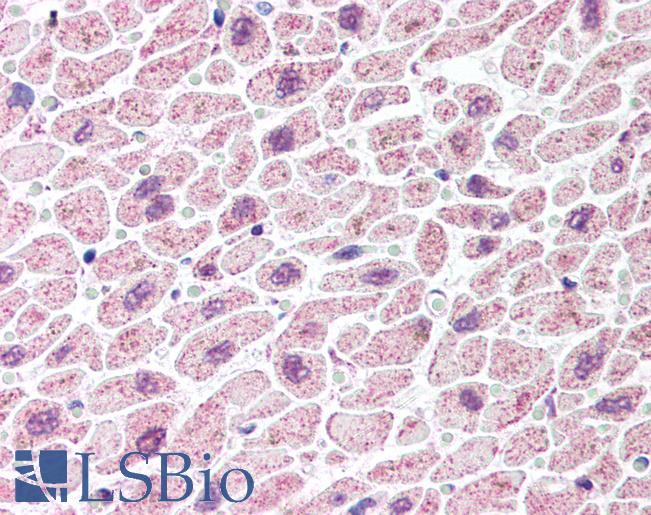 TDP-43 / TARDBP Antibody - Anti-TARDBP antibody IHC of human heart. Immunohistochemistry of formalin-fixed, paraffin-embedded tissue after heat-induced antigen retrieval. Antibody concentration 5 ug/ml.  This image was taken for the unconjugated form of this product. Other forms have not been tested.