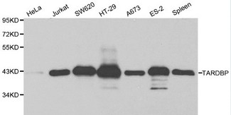 TDP-43 / TARDBP Antibody - Western blot of TARDBP pAb in extracts from Hela, Jurkat, SW620, HT-29, A673, ES-2 cells and mouse spleen tissue.