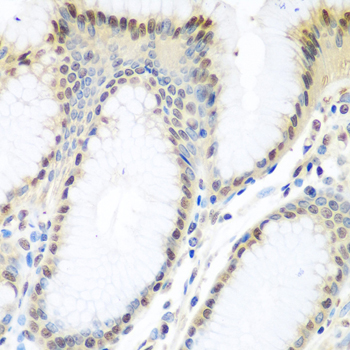 TDP-43 / TARDBP Antibody - Immunohistochemistry of paraffin-embedded human stomach tissue.