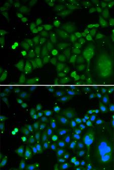 TDP-43 / TARDBP Antibody - Immunofluorescence analysis of HeLa cells.