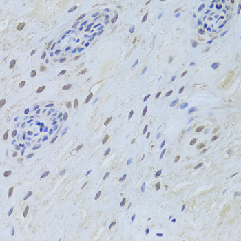TDP-43 / TARDBP Antibody - Immunohistochemistry of paraffin-embedded human esophagus using TARDBP Antibodyat dilution of 1:200 (40x lens).