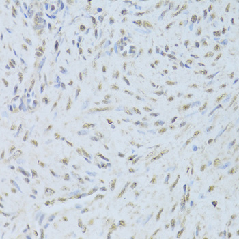 TDP-43 / TARDBP Antibody - Immunohistochemistry of paraffin-embedded human endometrium using TARDBP Antibodyat dilution of 1:200 (40x lens).
