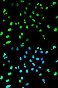 TDP-43 / TARDBP Antibody - Immunofluorescence analysis of HeLa cells using TARDBP antibody. Blue: DAPI for nuclear staining.