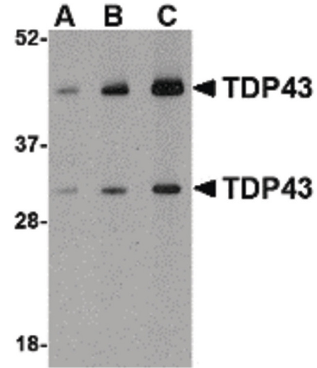 TDP-43 / TARDBP Antibody - Western blot of TDP43 in HeLa cell lysate with TDP43 antibody at (A) 0.5, (B) 1 and (C) 2 ug/ml.