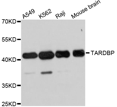 TDP-43 / TARDBP Antibody - Western blot analysis of extracts of various cell lines, using TARDBP antibody at 1:1000 dilution. The secondary antibody used was an HRP Goat Anti-Rabbit IgG (H+L) at 1:10000 dilution. Lysates were loaded 25ug per lane and 3% nonfat dry milk in TBST was used for blocking. An ECL Kit was used for detection and the exposure time was 1s.