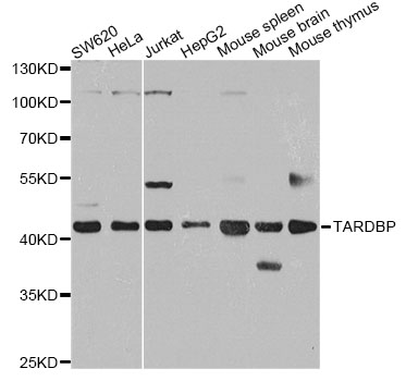 TDP-43 / TARDBP Antibody - Western blot analysis of extracts of various cell lines, using TARDBP antibody at 1:1000 dilution. The secondary antibody used was an HRP Goat Anti-Rabbit IgG (H+L) at 1:10000 dilution. Lysates were loaded 25ug per lane and 3% nonfat dry milk in TBST was used for blocking. An ECL Kit was used for detection and the exposure time was 30s.
