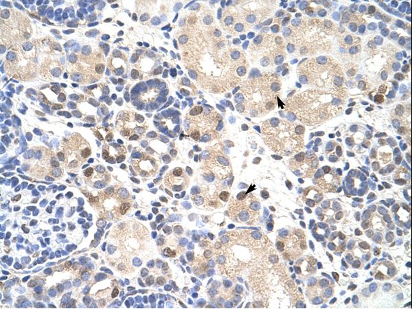 TDP-43 / TARDBP Antibody - TARDBP antibody ARP38941_T100-NP_031401-TARDBP (TAR DNA binding protein) Antibody was used in IHC to stain formalin-fixed, paraffin-embedded human kidney.  This image was taken for the unconjugated form of this product. Other forms have not been tested.