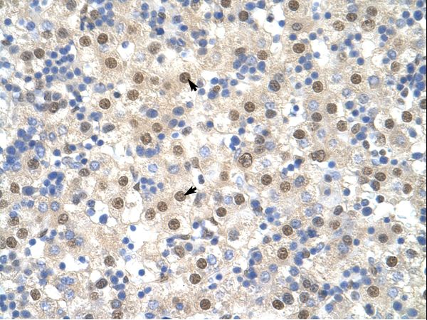 TDP-43 / TARDBP Antibody - TARDBP antibody ARP38941_T100-NP_031401-TARDBP (TAR DNA binding protein) Antibody was used in IHC to stain formalin-fixed, paraffin-embedded human liver.  This image was taken for the unconjugated form of this product. Other forms have not been tested.