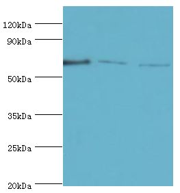 TDP1 Antibody - Western blot. All lanes: Tyrosyl-DNA phosphodiesterase 1 antibody at 8 ug/ml. Lane 1: MCF7 whole cell lysate. Lane 2: mouse lung tissue. Lane 3: Rat brain tissue. secondary Goat polyclonal to rabbit at 1:10000 dilution. Predicted band size: 68 kDa. Observed band size: 68 kDa.