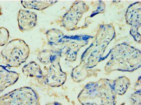 TDP1 Antibody - Immunohistochemistry of paraffin-embedded human placenta using antibody at 1:100 dilution.