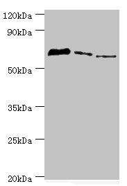 TDP1 Antibody - Western blot All lanes: Tyrosyl-DNA phosphodiesterase 1 antibody at 8µg/ml Lane 1: MCF-7 whole cell lysate Lane 2: Mouse lung tissue Lane 3: Rat brain tissue Secondary Goat polyclonal to rabbit IgG at 1/10000 dilution Predicted band size: 69, 42 kDa Observed band size: 69 kDa