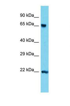 TDP1 Antibody - Western blot of Mouse Lung. Tdp1 antibody dilution 1.0 ug/ml.  This image was taken for the unconjugated form of this product. Other forms have not been tested.