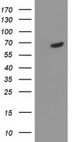 TDP1 Antibody - HEK293T cells were transfected with the pCMV6-ENTRY control (Left lane) or pCMV6-ENTRY TDP1 (Right lane) cDNA for 48 hrs and lysed. Equivalent amounts of cell lysates (5 ug per lane) were separated by SDS-PAGE and immunoblotted with anti-TDP1.