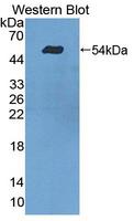 TDP1 Antibody - Western Blot; Sample: Recombinant protein.