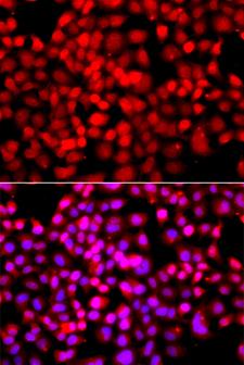 TDP1 Antibody - Immunofluorescence analysis of A549 cells.