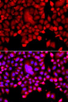 TDP1 Antibody - Immunofluorescence analysis of A549 cells.