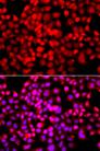 TDP1 Antibody - Immunofluorescence analysis of A549 cells using TDP1 Polyclonal Antibody.