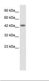 TDP2 / TTRAP Antibody - HepG2 Cell Lysate.  This image was taken for the unconjugated form of this product. Other forms have not been tested.