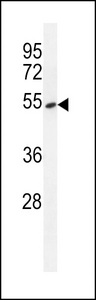 TDP2 / TTRAP Antibody - EAPII Antibody western blot of A549 cell line lysates (35 ug/lane). The EAPII antibody detected the EAPII protein (arrow).