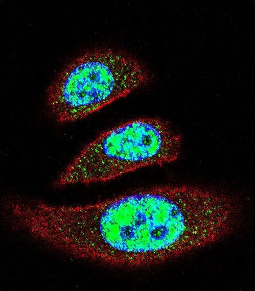 TDP2 / TTRAP Antibody - Confocal immunofluorescence of EAPII Antibody with A549 cell followed by Alexa Fluor 488-conjugated goat anti-rabbit lgG (green). Actin filaments have been labeled with Alexa Fluor 555 phalloidin (red). DAPI was used to stain the cell nuclear (blue).