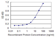 TDP2 / TTRAP Antibody - Detection limit for recombinant GST tagged TTRAP is 0.3 ng/ml as a capture antibody.