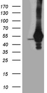TDP2 / TTRAP Antibody - HEK293T cells were transfected with the pCMV6-ENTRY control. (Left lane) or pCMV6-ENTRY TDP2. (Right lane) cDNA for 48 hrs and lysed