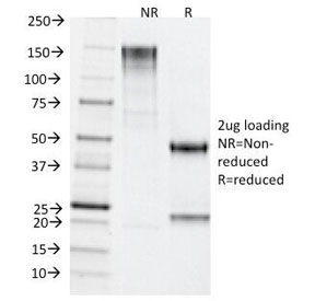 TDP2 / TTRAP Antibody - SDS-PAGE Analysis of Purified, BSA-Free TDP2 Antibody (clone TDP2/1258). Confirmation of Integrity and Purity of the Antibody.