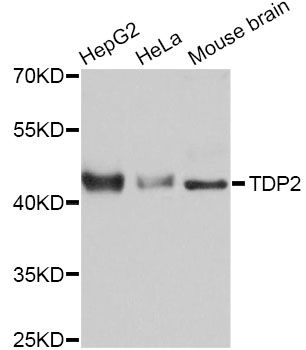 TDP2 / TTRAP Antibody - Western blot analysis of extracts of various cell lines, using TDP2 Antibody at 1:3000 dilution. The secondary antibody used was an HRP Goat Anti-Rabbit IgG (H+L) at 1:10000 dilution. Lysates were loaded 25ug per lane and 3% nonfat dry milk in TBST was used for blocking. An ECL Kit was used for detection and the exposure time was 1s.