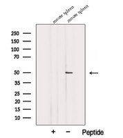 TDP2 / TTRAP Antibody - Western blot analysis of extracts of mouse spleen tissue using TTRAP antibody. The lane on the left was treated with blocking peptide.