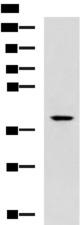 TDP2 / TTRAP Antibody - Western blot analysis of Mouse small intestines tissue lysate  using TDP2 Polyclonal Antibody at dilution of 1:600