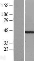TDP2 / TTRAP Protein - Western validation with an anti-DDK antibody * L: Control HEK293 lysate R: Over-expression lysate