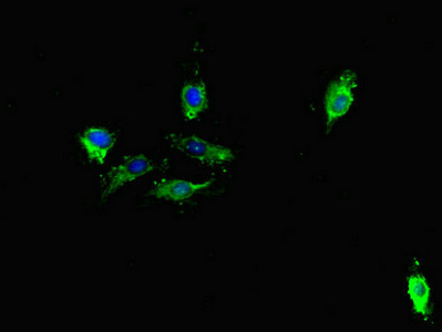 TDRD1 Antibody - Immunofluorescent analysis of Hela cells diluted at 1:100 and Alexa Fluor 488-congugated AffiniPure Goat Anti-Rabbit IgG(H+L)