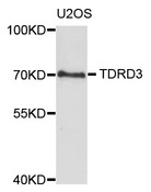 TDRD3 Antibody - Western blot analysis of extracts of U2OS cells.