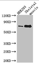 TDRD3 Antibody - Western Blot Positive WB detected in:HEK293 whole cell lysate,Mouse skeletal muscle tissue All Lanes: TDRD3 antibody at 3ug/ml Secondary Goat polyclonal to rabbit IgG at 1/50000 dilution Predicted band size: 74,84 kDa Observed band size: 74 kDa