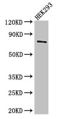 TDRD3 Antibody - Western Blot Positive WB detected in: HEK293 whole cell lysate All lanes: TDRD3 antibody at 3µg/ml Secondary Goat polyclonal to rabbit IgG at 1/50000 dilution Predicted band size: 74, 84 kDa Observed band size: 74 kDa