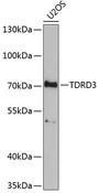 TDRD3 Antibody - Western blot analysis of extracts of U2OS cells using TDRD3 Polyclonal Antibody at dilution of 1:1000.