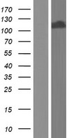TDRD5 Protein - Western validation with an anti-DDK antibody * L: Control HEK293 lysate R: Over-expression lysate