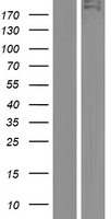 TDRD6 Protein - Western validation with an anti-DDK antibody * L: Control HEK293 lysate R: Over-expression lysate