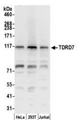 TDRD7 Antibody - Detection of human TDRD7 by western blot. Samples: Whole cell lysate (50 µg) from HeLa, HEK293T, and Jurkat cells prepared using NETN lysis buffer. Antibody: Affinity purified rabbit anti-TDRD7 antibody used for WB at 0.4 µg/ml. Detection: Chemiluminescence with an exposure time of 30 seconds.