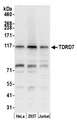 TDRD7 Antibody - Detection of human TDRD7 by western blot. Samples: Whole cell lysate (50 µg) from HeLa, HEK293T, and Jurkat cells prepared using NETN lysis buffer. Antibody: Affinity purified rabbit anti-TDRD7 antibody used for WB at 0.4 µg/ml. Detection: Chemiluminescence with an exposure time of 30 seconds.