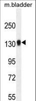 TDRD7 Antibody - TDRD7 Antibody western blot of mouse bladder tissue lysates (35 ug/lane). The TDRD7 antibody detected the TDRD7 protein (arrow).