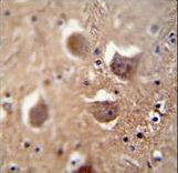 TDRD7 Antibody - TDRD7 antibody immunohistochemistry of formalin-fixed and paraffin-embedded human brain tissue followed by peroxidase-conjugated secondary antibody and DAB staining.