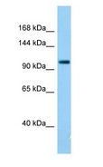 TDRD7 Antibody - TDRD7 antibody Western Blot of Rat Small Intestine.  This image was taken for the unconjugated form of this product. Other forms have not been tested.